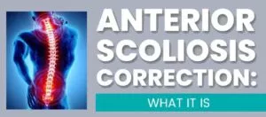 Anterior Scoliosis Correction